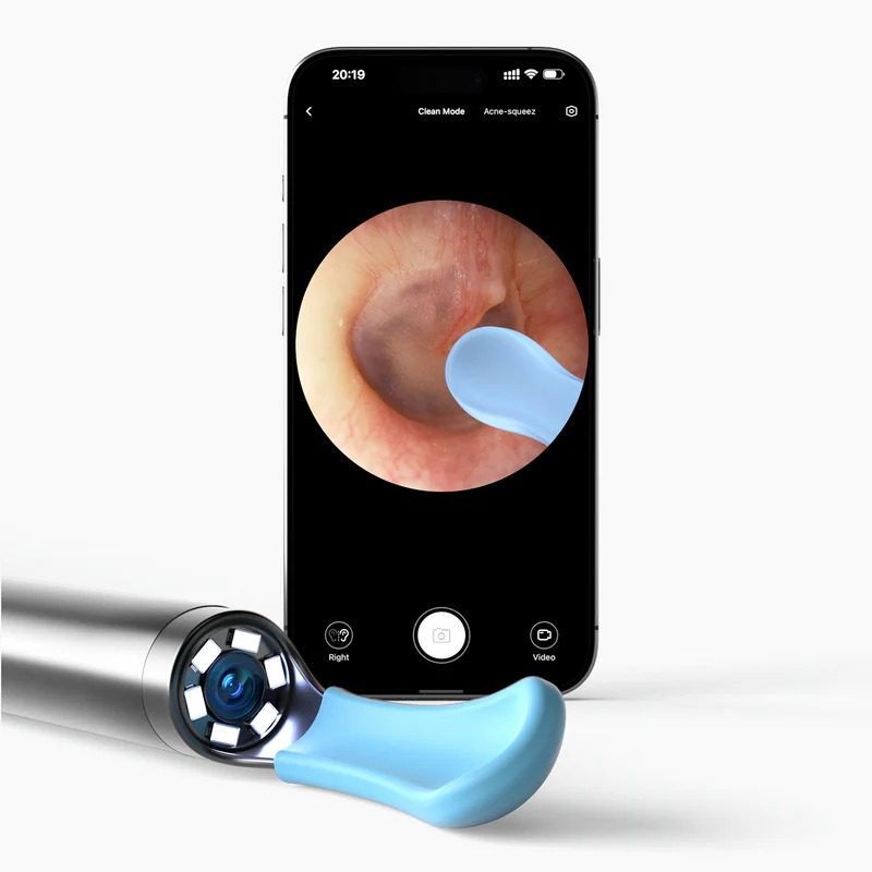 Bebird Smart Ear Cleaner EarSight R1 - Image 4